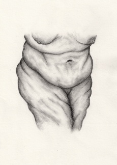 Rebecca D Harris, drawing of a medical illustration image depicting excess skin, 2013