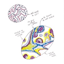 Sketch of disease cells by Kath Howard (2014)